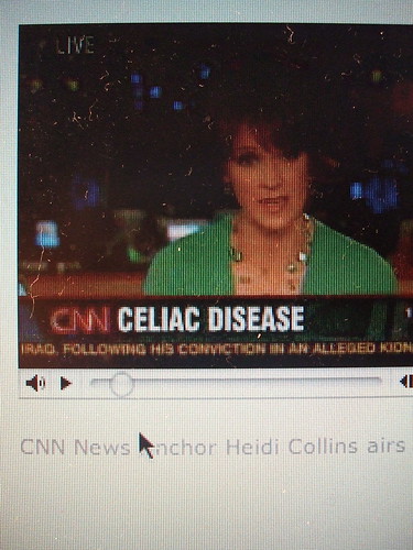 Μικρογραφία εικόνας για το CNN και την κοιλιακή