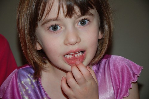 Gracie's First Lost Tooth