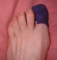 toe bandage