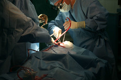 Hydrocephalus Surgery