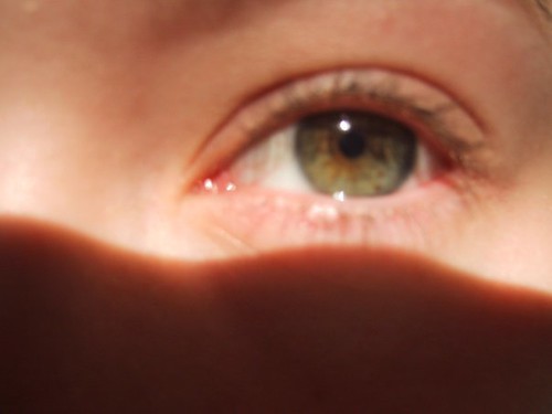 freckle eye