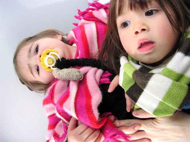 conjoined twins abby and brittany. conjoined twins | Flickr