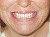 toothy grin 2