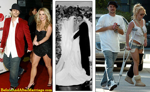britney spears  before after