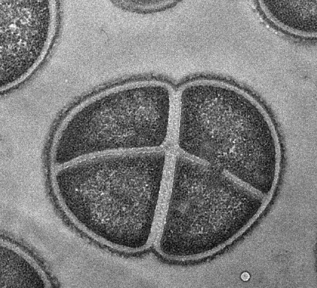 Deinococcus Radiodurans | Flickr - Photo Sharing!