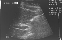 Contoh Gambar Ultrasonography