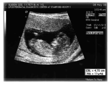Ultrasound Image of Max