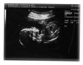 Max Ultrasound in 5th month