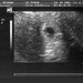 See the Baby Sonogram Images (Hailey's Gestation) set