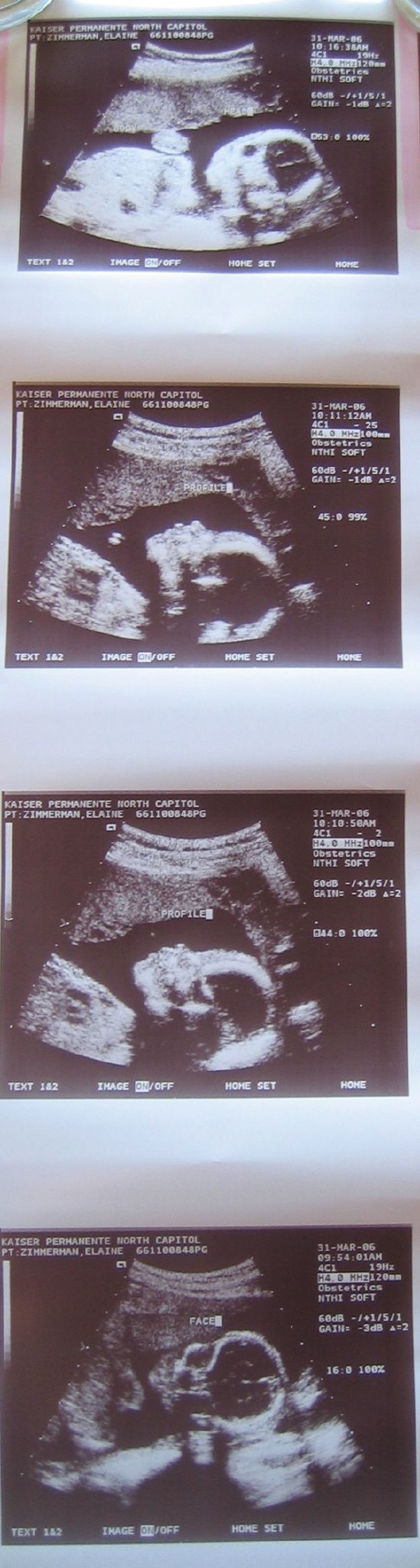 22+weeks+pregnant+images