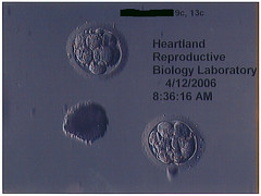 Embryos 9c &13c