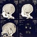 See the Hailey's First MRI Images (March 19, 2003) set
