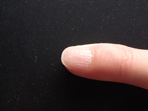 My little finger