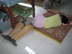 landmine survivor asleep at mae sot