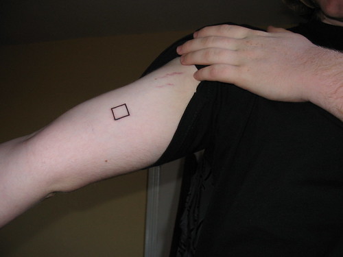 Small square on right upper arm