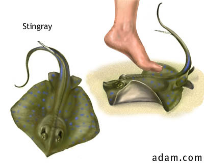 Stingray-1