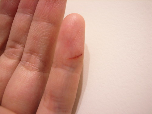 i slashed my finger...