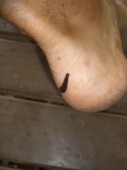 Leech!