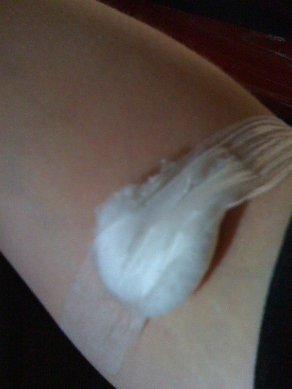 Blood test