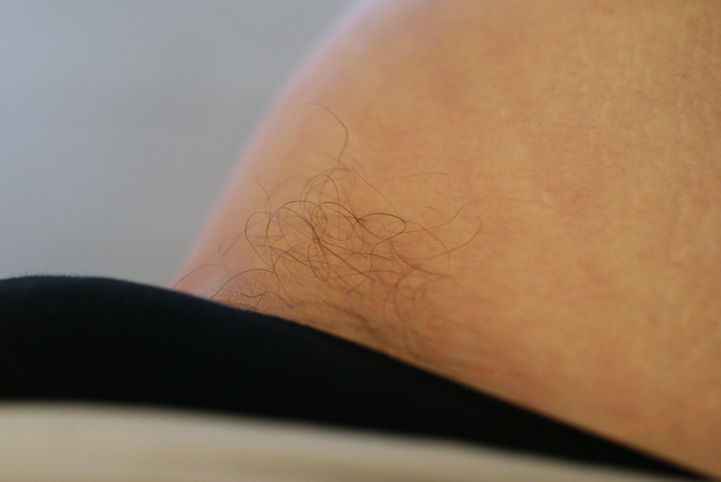 GROIN