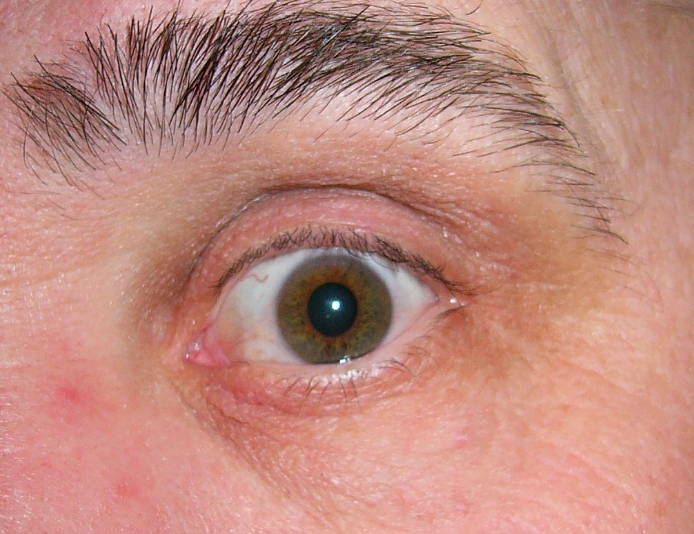 mark eye 2