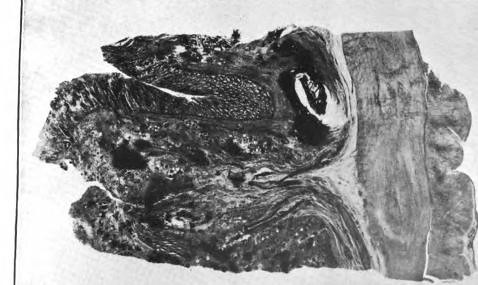 This image is taken from United States Naval Medical Bulletin Vol. 8, Nos. 1-4, 1914
