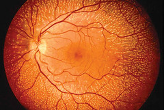 retina umana